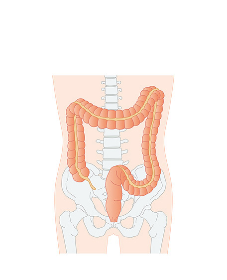 大腸1の画像