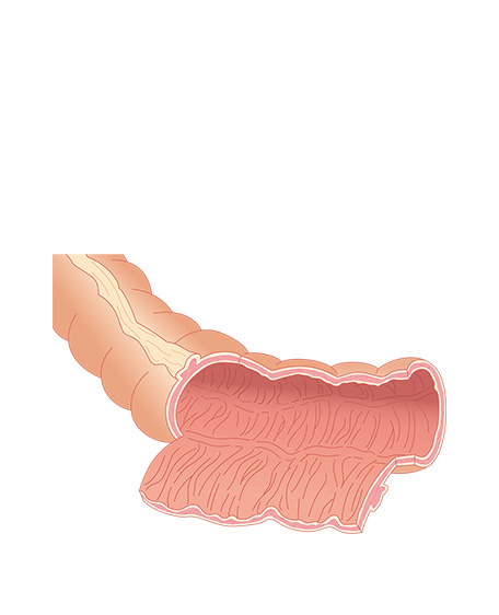 大腸2の画像