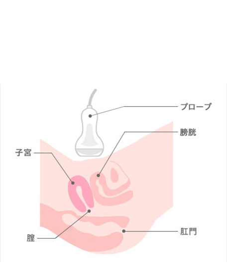 経腹部超音波検査2の画像