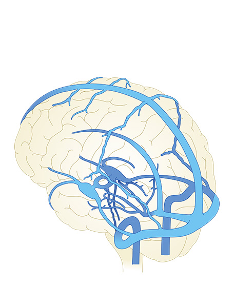脳静脈系の全貌の画像
