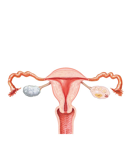 子宮・卵巣の画像