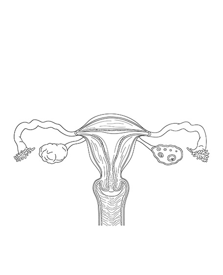 子宮・卵巣（モノクロ）の画像