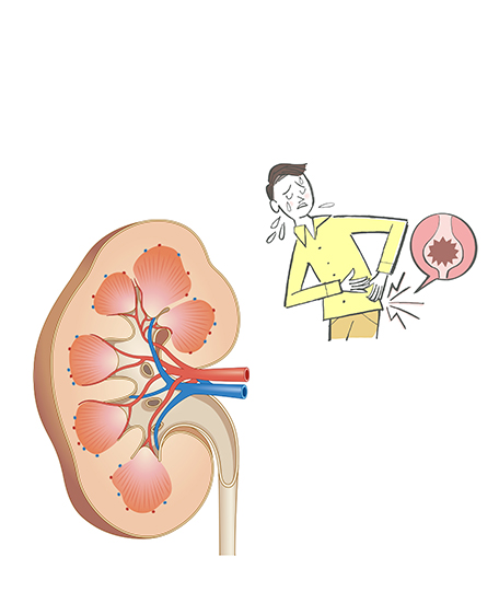 腎・泌尿器の画像