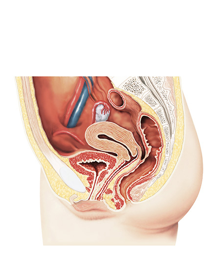 女性器断面の画像