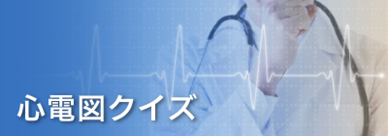 心電図クイズ