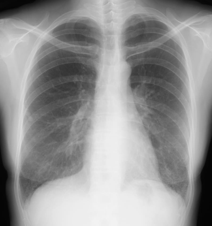 X 線検査結果画像