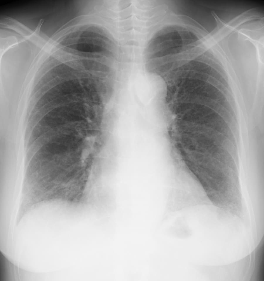 X 線検査結果画像