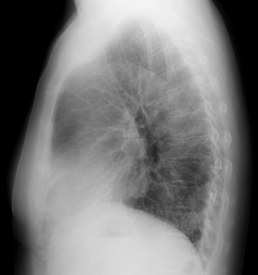 X 線検査結果画像