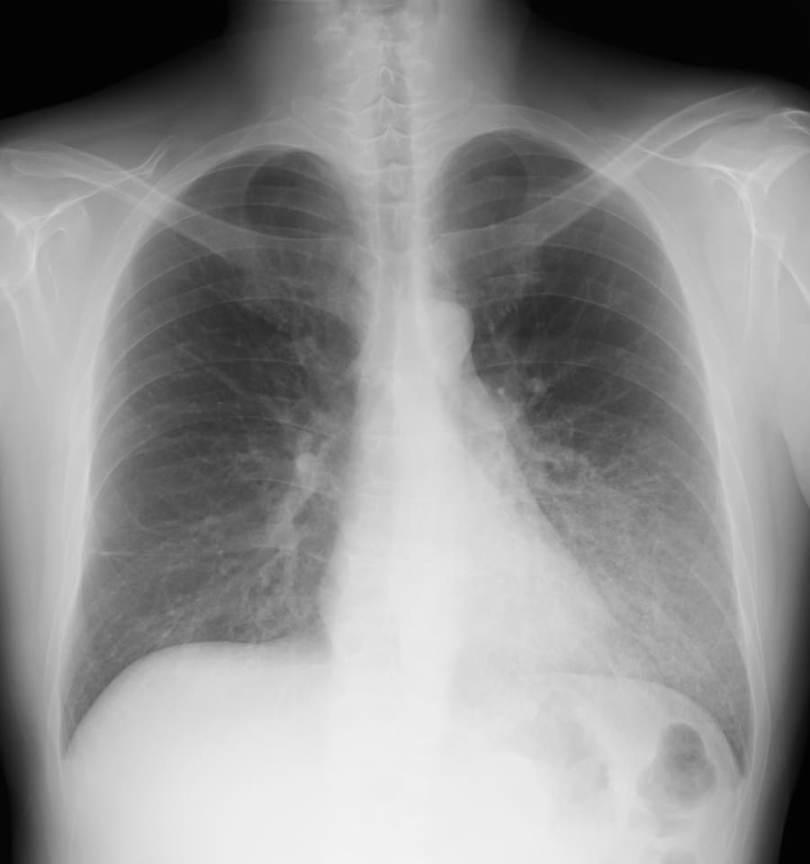 X 線検査結果画像