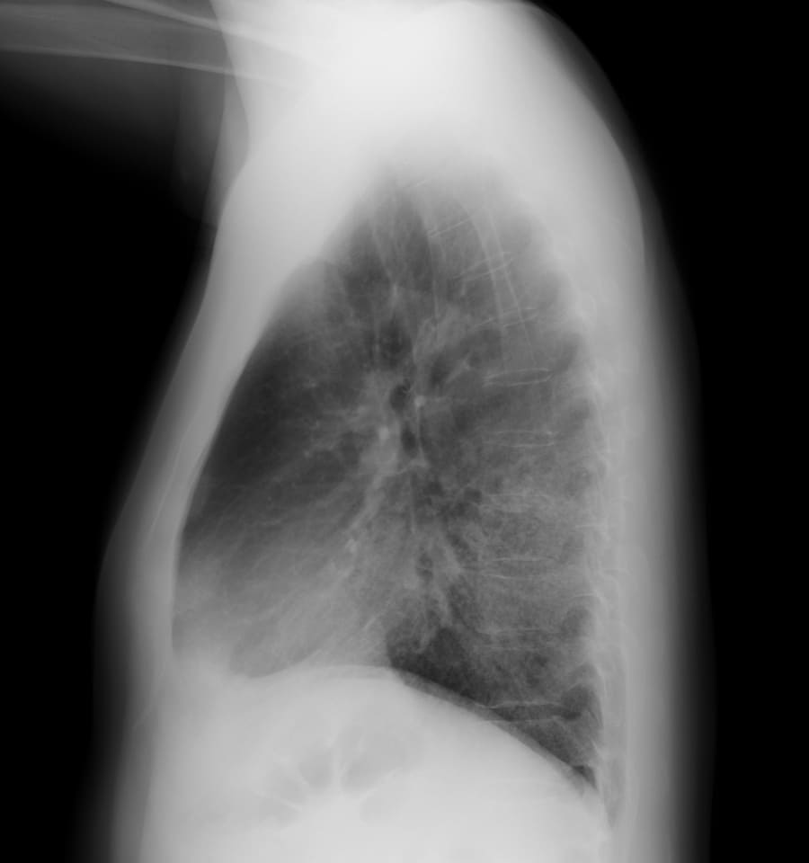 X 線検査結果画像