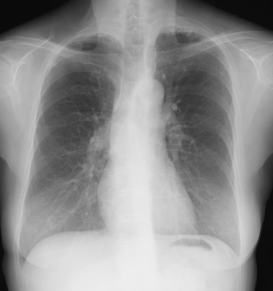 X 線検査結果画像