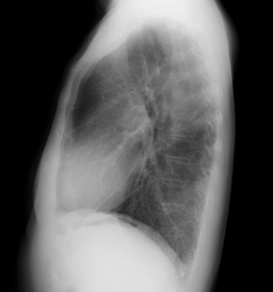 X 線検査結果画像