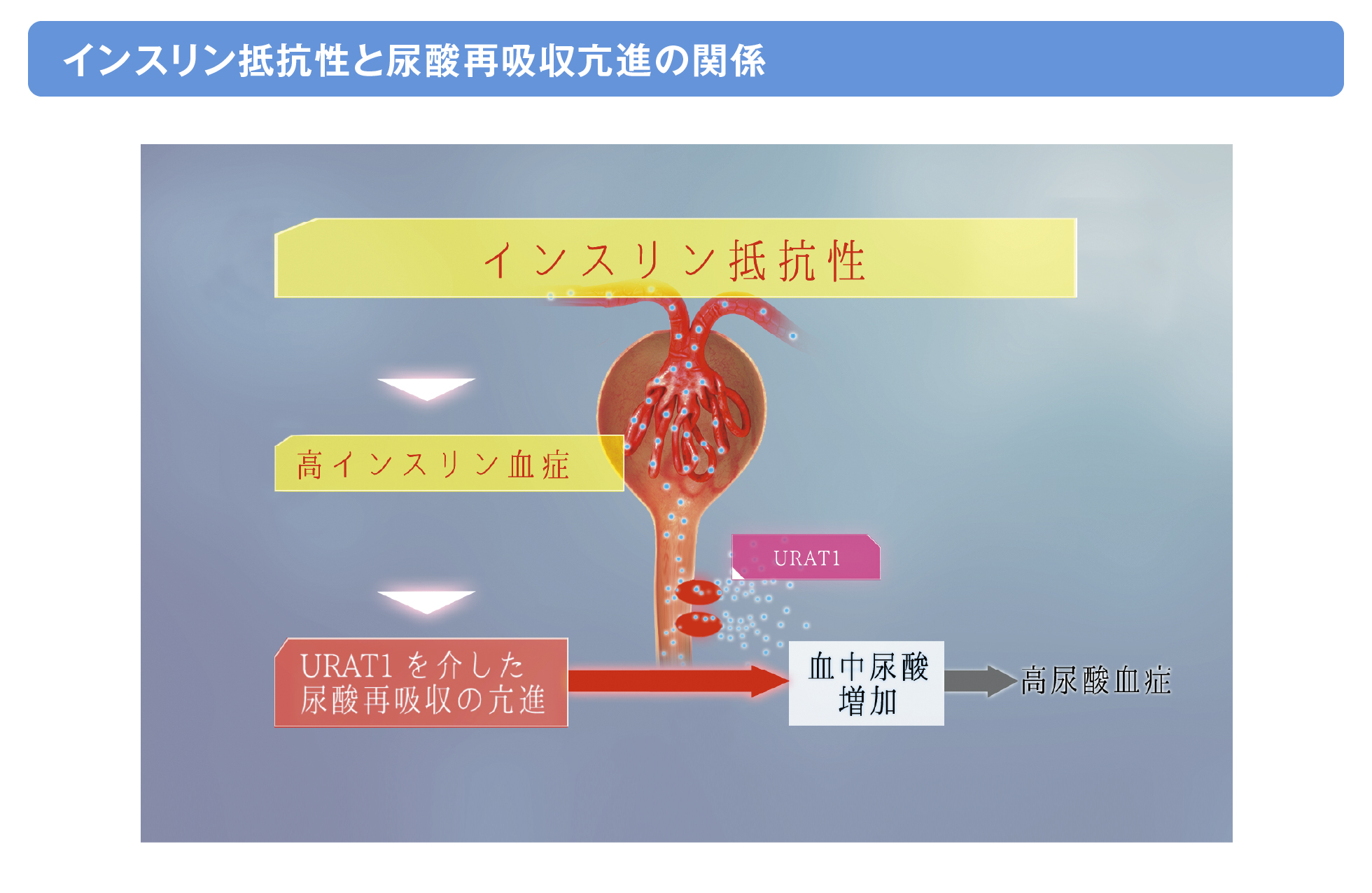 インスリン抵抗性と尿酸再吸収亢進の関係の画像